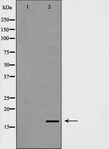 Polyclonal Rabbit anti-Human NDUFA13 / GRIM19 Antibody (IHC, WB)