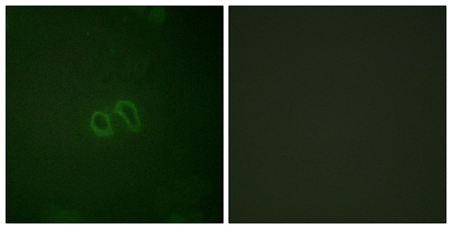 VCL / Vinculin Antibody (phospho-Tyr821)