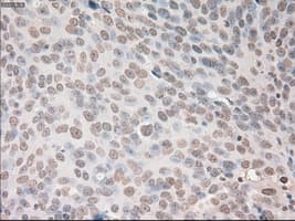 VEGFA / VEGF Antibody (clone OTI2F7)