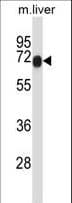 HIPK4 Antibody (aa533-562)