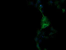 TRIM38 Antibody (clone OTI15H4)