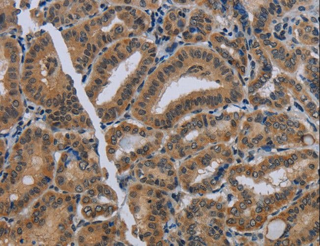 NAT10 Antibody