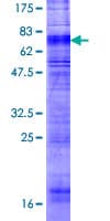 Human OX1R / Orexin Receptor 1 Protein (Recombinant GST)