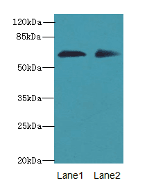 Polyclonal Rabbit anti-Human ZNF529 Antibody (WB)