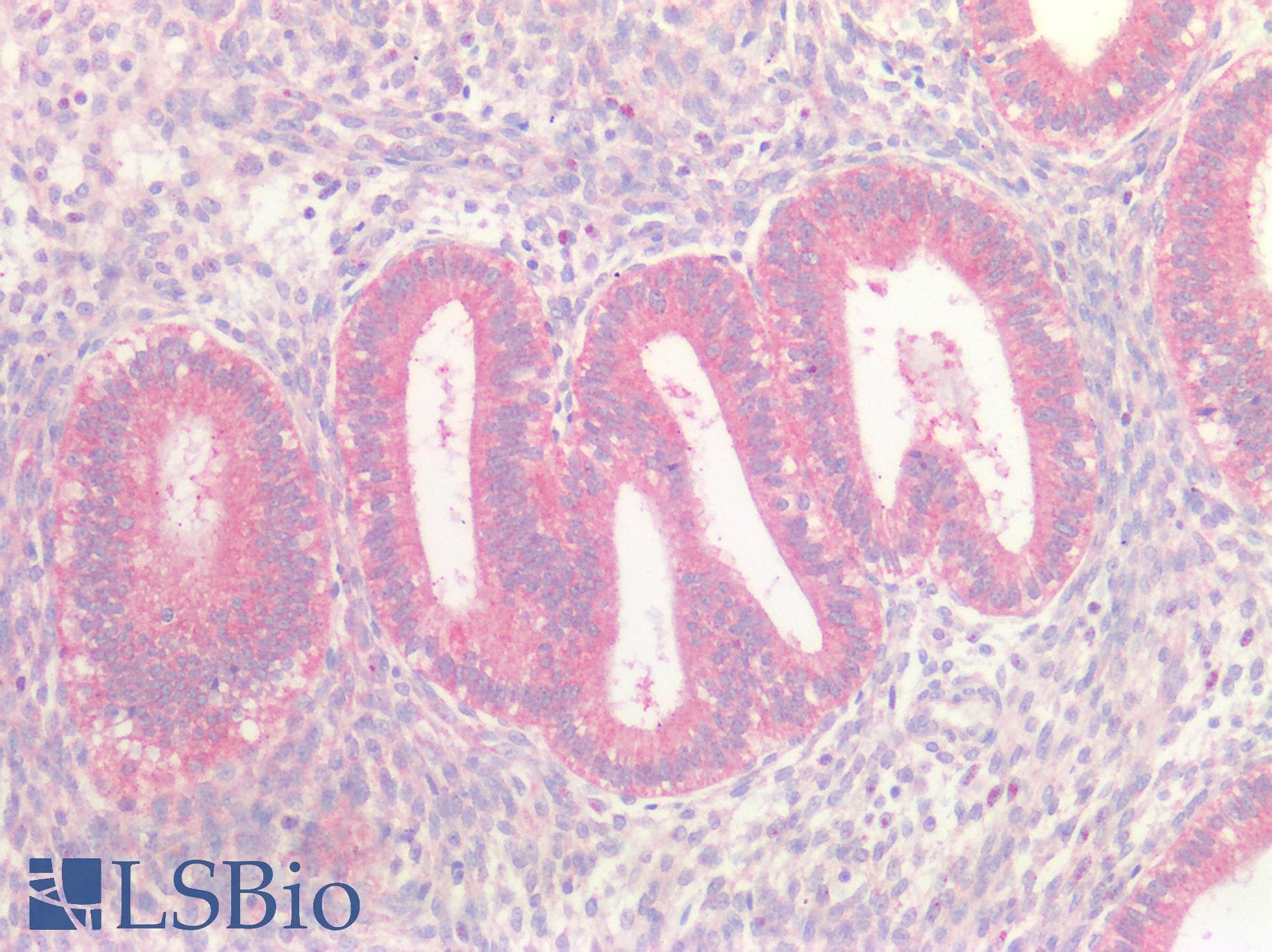PathPlus™ BRAF / B-Raf Antibody (clone 1H12)
