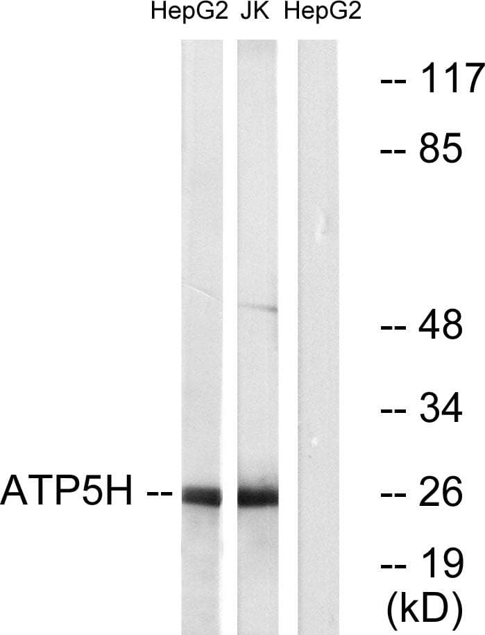 Polyclonal Rabbit anti-Human ATP5H Antibody (WB)