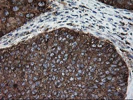 MAC-2-BP / LGALS3BP Antibody (clone OTI3G8)