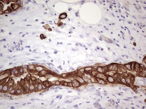 Monoclonal Mouse anti-Human Acidic Cytokeratin AE1 Antibody (clone AE1, IHC)
