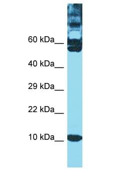 TXN / Thioredoxin / TRX Antibody (aa51-100)