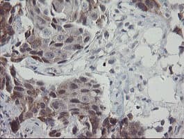 APP / Beta Amyloid Precursor Antibody (clone OTI6F11, Carrier-free)