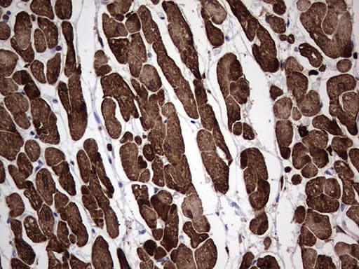 TNNC1 / Cardiac Troponin C Antibody (clone OTI1H5)