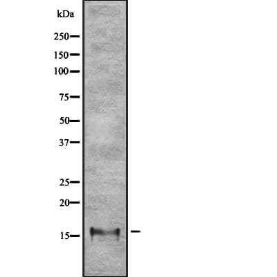 CLC Antibody