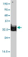 ANXA2 / Annexin A2 Antibody (clone 3E8-B6)