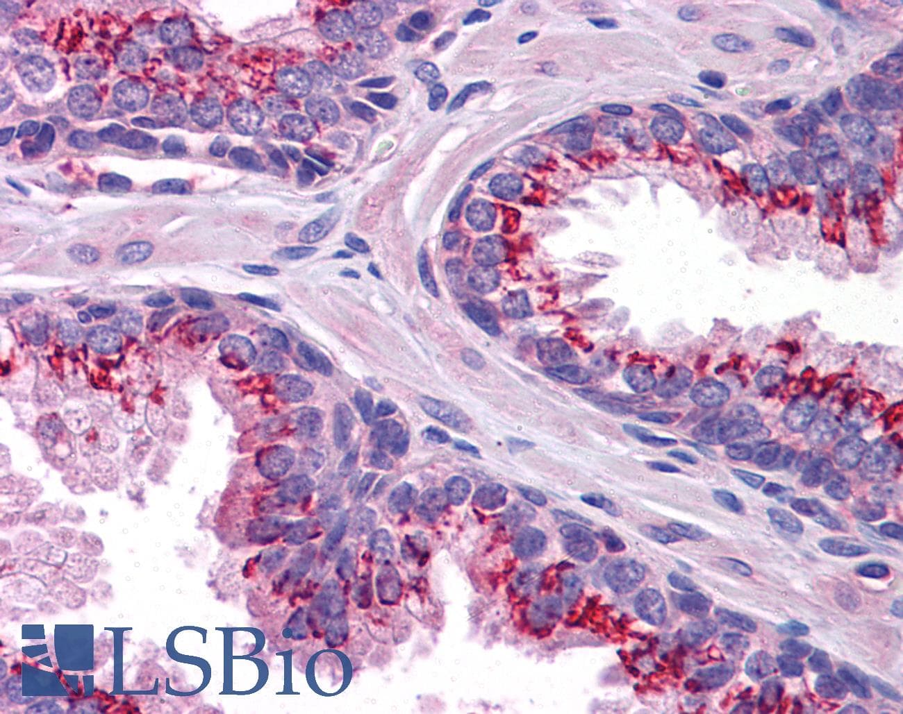 IHC-plus™ SLC37A2 Antibody