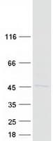 Human RMND5B Protein (Recombinant Myc-DDK (Flag))