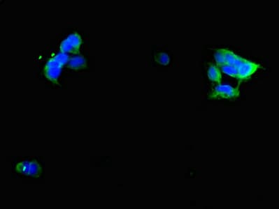 GIPR / GIP Receptor Antibody