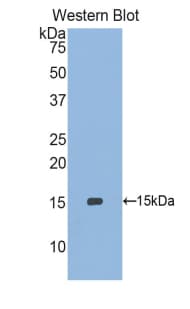 SEPX1 / Selenoprotein R Antibody (aa1-116, Cy3)