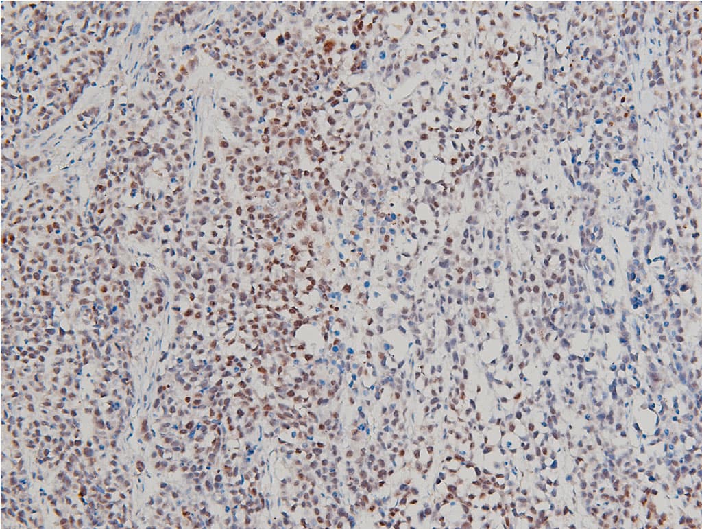 LIMK1 / LIMK Antibody (phospho-Thr508)