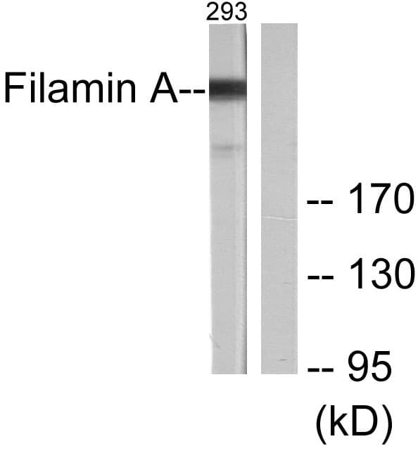 IHC-plus™ Polyclonal Rabbit anti-Human FLNA / Filamin A Antibody (aa2121-2170, IHC, WB)