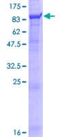 Human BBS12 Protein (Recombinant GST)