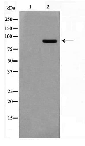 Polyclonal Rabbit anti-Human AAK1 Antibody (WB)