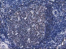 CTDSP1 / SCP1 Antibody (clone OTI1B5)