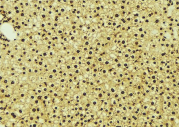 Polyclonal Rabbit anti-Human NR1I3 / CAR Antibody (IHC, IF, WB)
