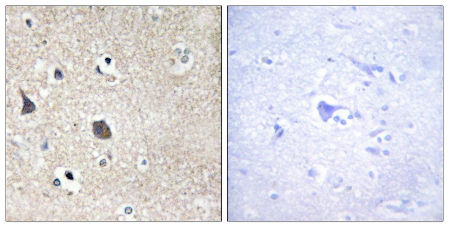 MID1 Antibody