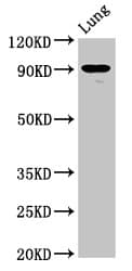 Polyclonal Rabbit anti-Human SEMA4B / Semaphorin 4B Antibody (IHC, WB)
