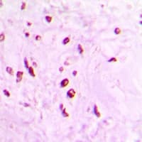 Polyclonal Rabbit anti-Human HTATSF1 / TAT-SF1 Antibody (IHC, WB)