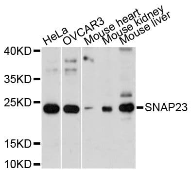 SNAP23 / SNAP-23 Antibody