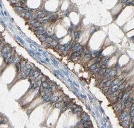 HSPA8 / HSC70 Antibody