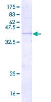 Human REDD-2 / DDIT4L Protein (Recombinant GST)