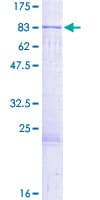 Human MUS81 Protein (Recombinant GST)