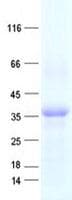 Human OVOL1 Protein (Recombinant His, N-Terminal)