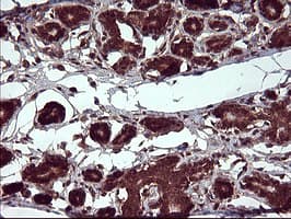 Placental Lactogen Antibody (clone OTI2G4)