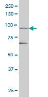 Monoclonal Mouse anti-Human TRIM36 Antibody (clone 2D11, IHC, IF, WB)