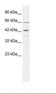 TRIM68 Antibody (aa279-328, HRP)