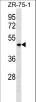 Polyclonal Rabbit anti-Human VN1R5 Antibody (aa214-241, WB)