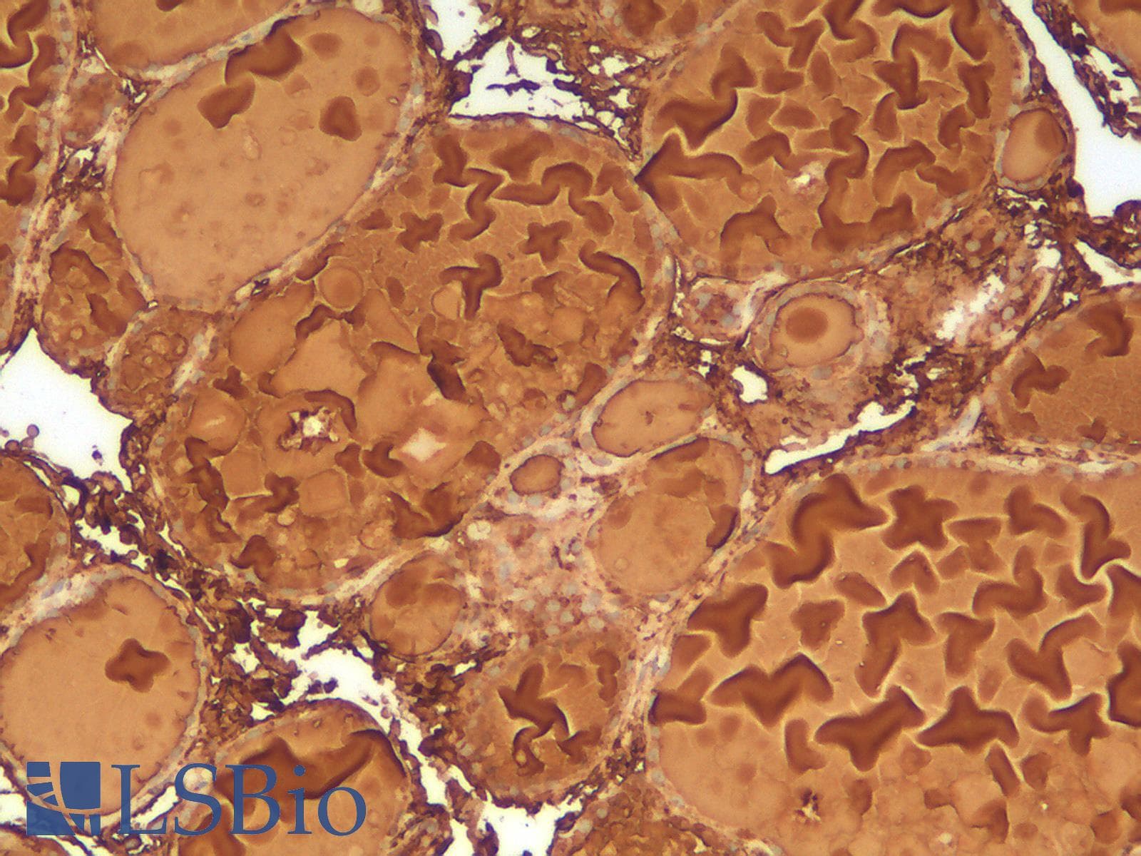 PathPlus™ TG / Thyroglobulin Antibody (clone rTGB24)