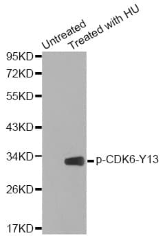 Polyclonal Rabbit anti-Human CDK6 Antibody (phospho-Tyr13, IHC, IF, WB)