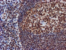 FMR1 / FMRP Antibody (clone OTI3B4)