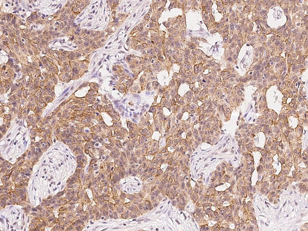 Polyclonal Rabbit anti-Human CDON / Cdo Antibody (IHC)