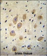 Polyclonal Rabbit anti-Human LOC339742 Antibody (aa 147-176, C-term, IHC, WB)