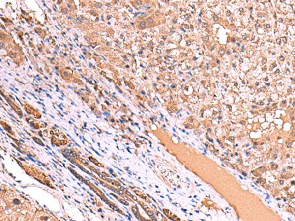 Polyclonal Rabbit anti-Human TTC38 Antibody (IHC, WB)