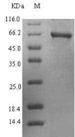 Human PRIM1 Protein (Recombinant 6His-SUMO, N-terminus)