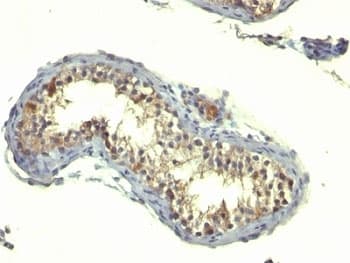 TGFA / TGF Alpha Antibody (aa34-43, clone TG86)