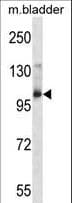 AAK1 Antibody (aa279-306)