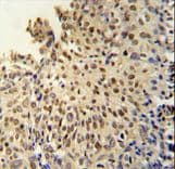 DIS3L Antibody (aa195-224)