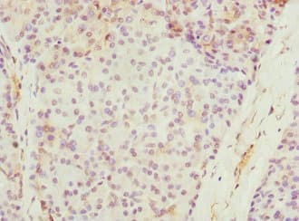 SAP30BP / HTRG Antibody